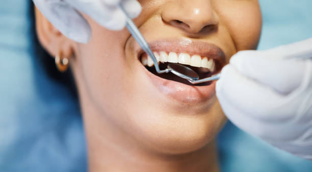 Best Knocked-Out Tooth Emergency  in Hughes Springs, TX